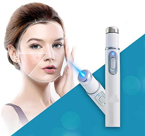 Euro-buy spider vein removal device